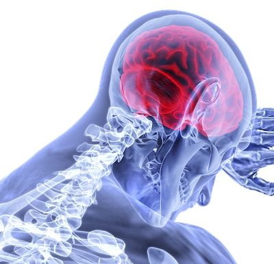 What Compensation Can I Receive for My Traumatic Brain Injury