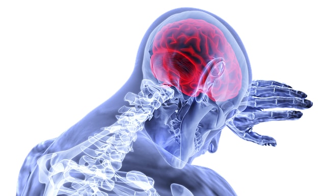 what-compensation-can-i-receive-for-my-traumatic-brain-injury