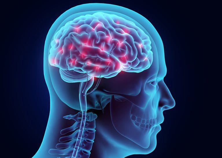 ¿Qué evidencia se necesita para una demanda por lesión cerebral traumática en Ohio?